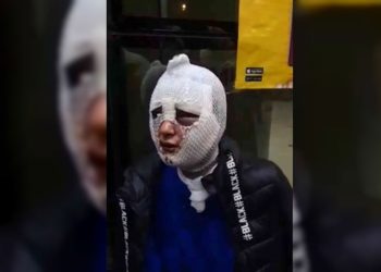 G.Ç’yi kızgın yağla yakan ‘İstihbarat muhbiriyim bana bir şey olmaz’ diyen Erkmen tahliye edildi